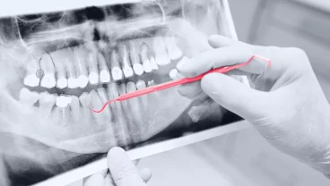 Développement d’un Algorithme d’Apprentissage Automatique pour la Détection des Dents