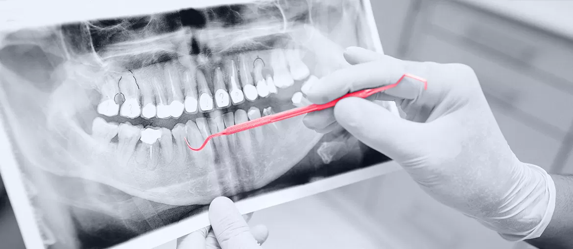 Développement d’un Algorithme d’Apprentissage Automatique pour la Détection des Dents